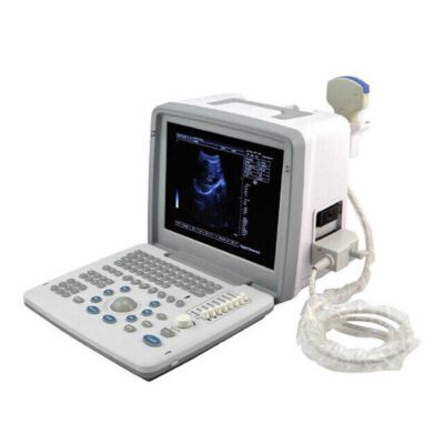S300 Portable Full Digital Ultrasound Machine