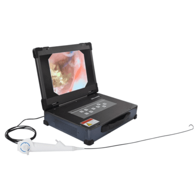 HD-340 2 in 1 Flexible and Rigid Endoscopic Endoscope Camera System